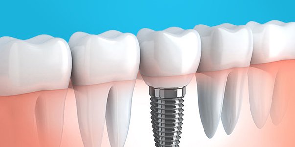 Dr. Draghescu Cornel - cabinet stomatologic